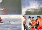 O surfista potiguar Aldemir Calunga acordou do coma induzido nesta...